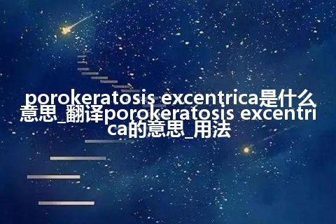 porokeratosis excentrica是什么意思_翻译porokeratosis excentrica的意思_用法